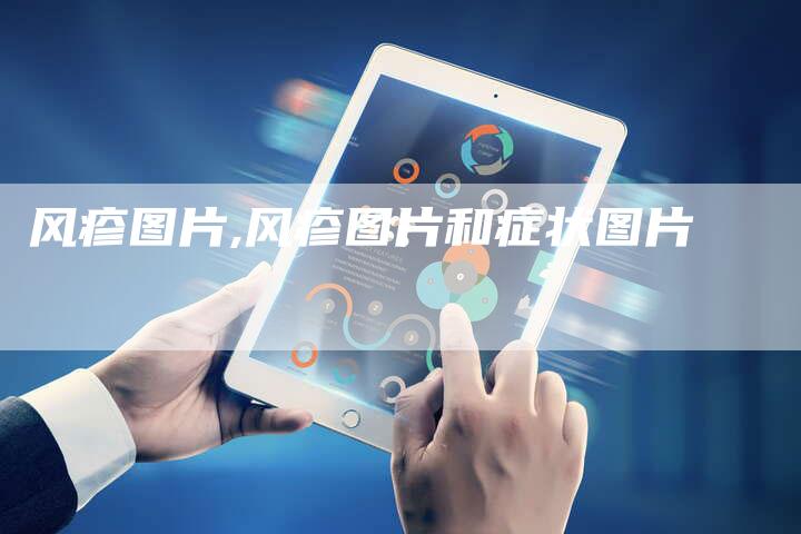 风疹图片,风疹图片和症状图片
