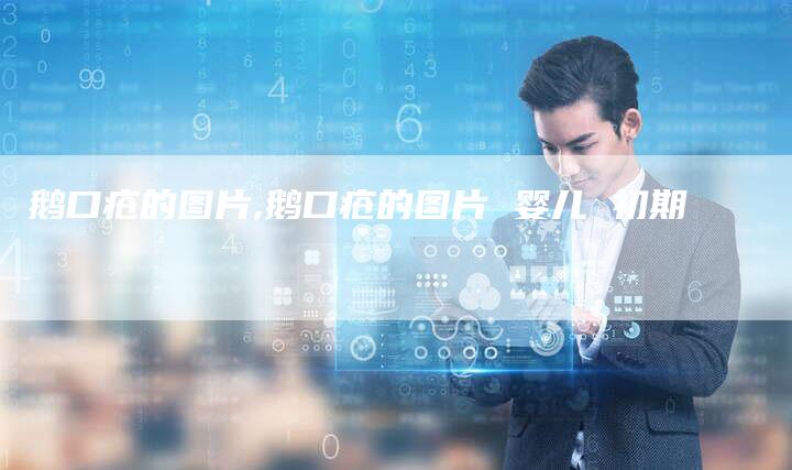 鹅口疮的图片,鹅口疮的图片 婴儿 初期